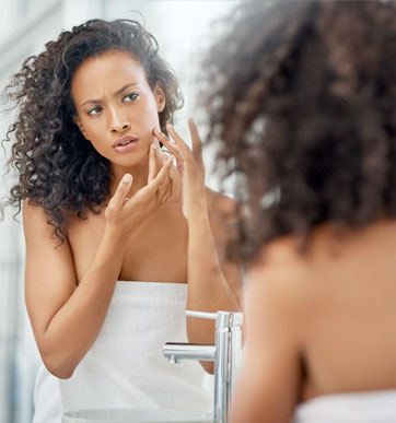 cystic-acne-hack